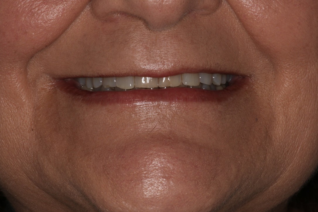 Before Image