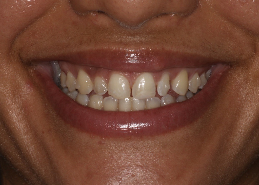 Before Image