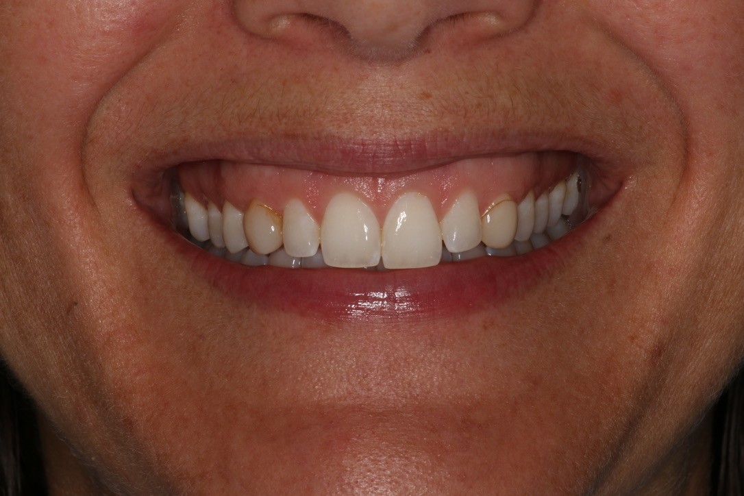 Before Image