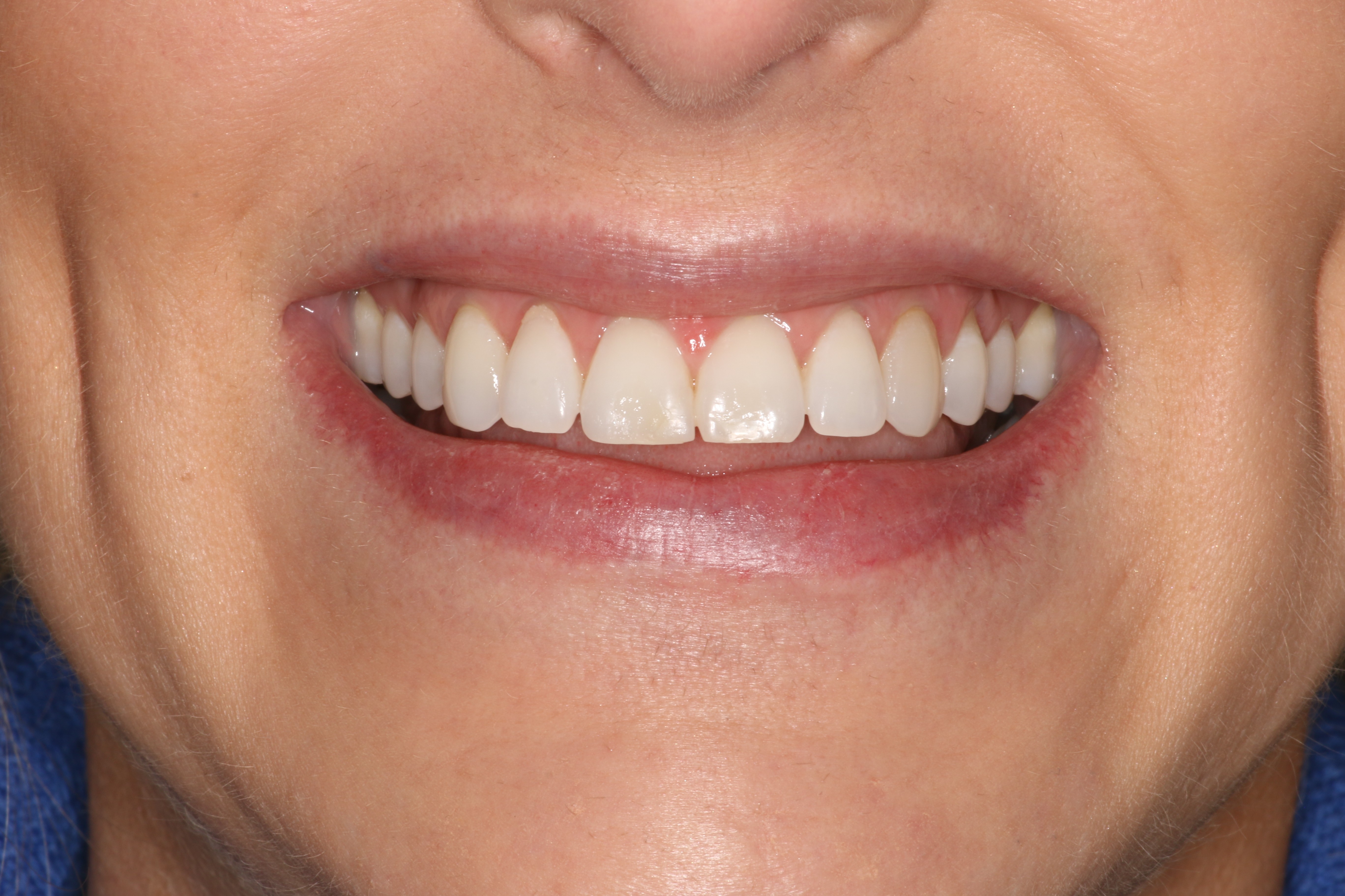 Before Image