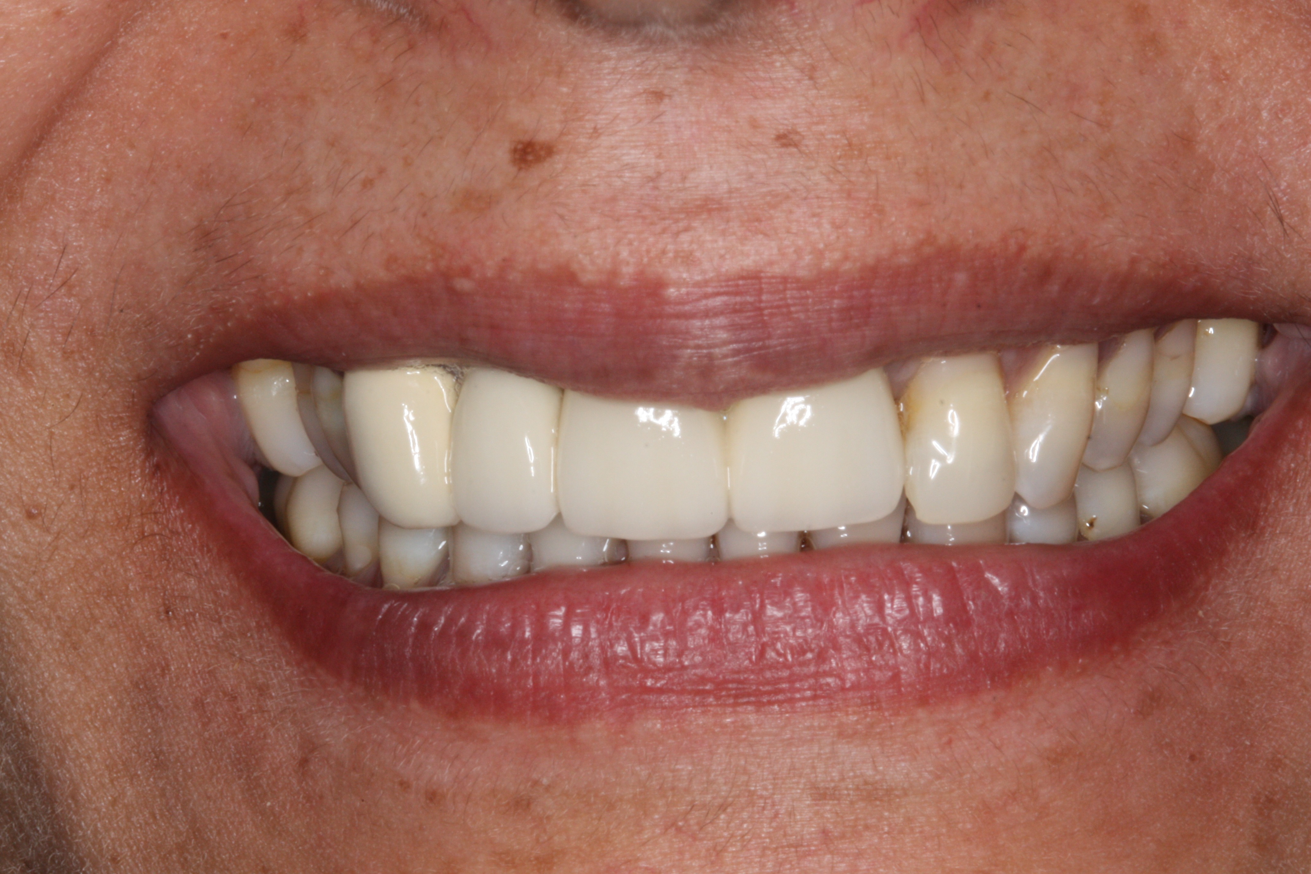 Before Image