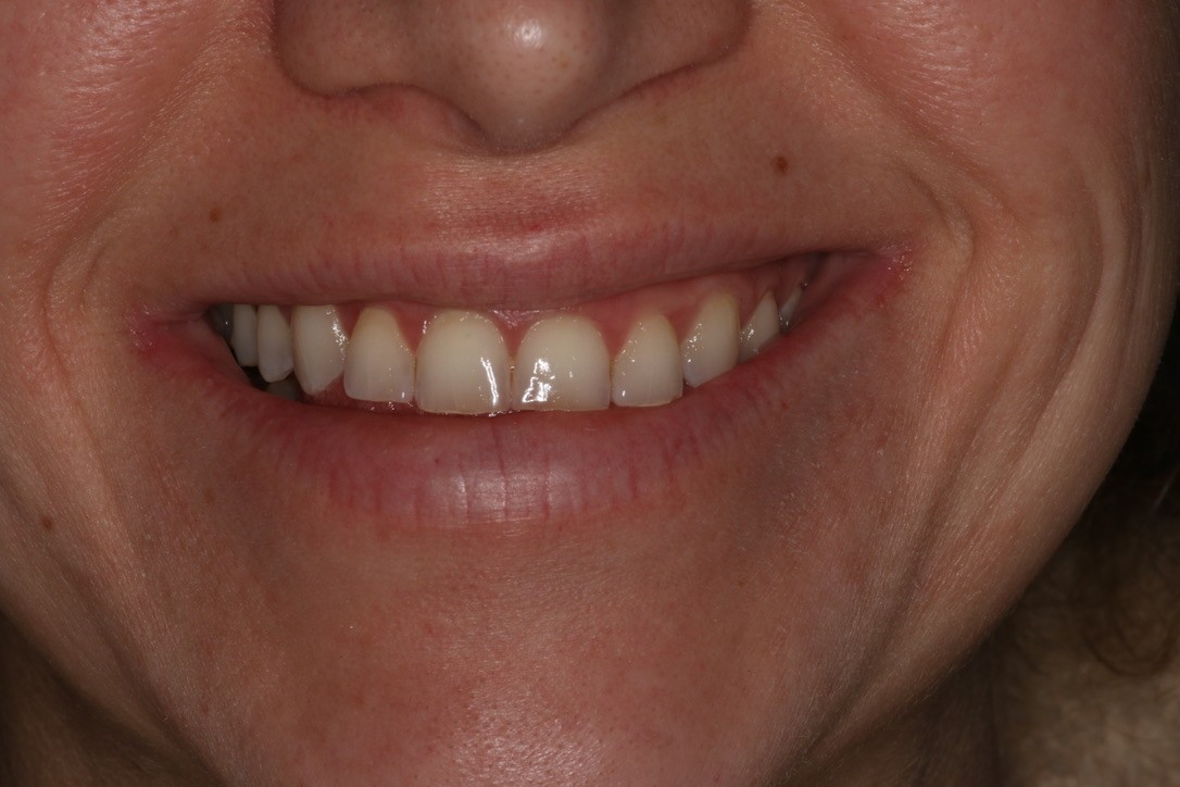 Before Image