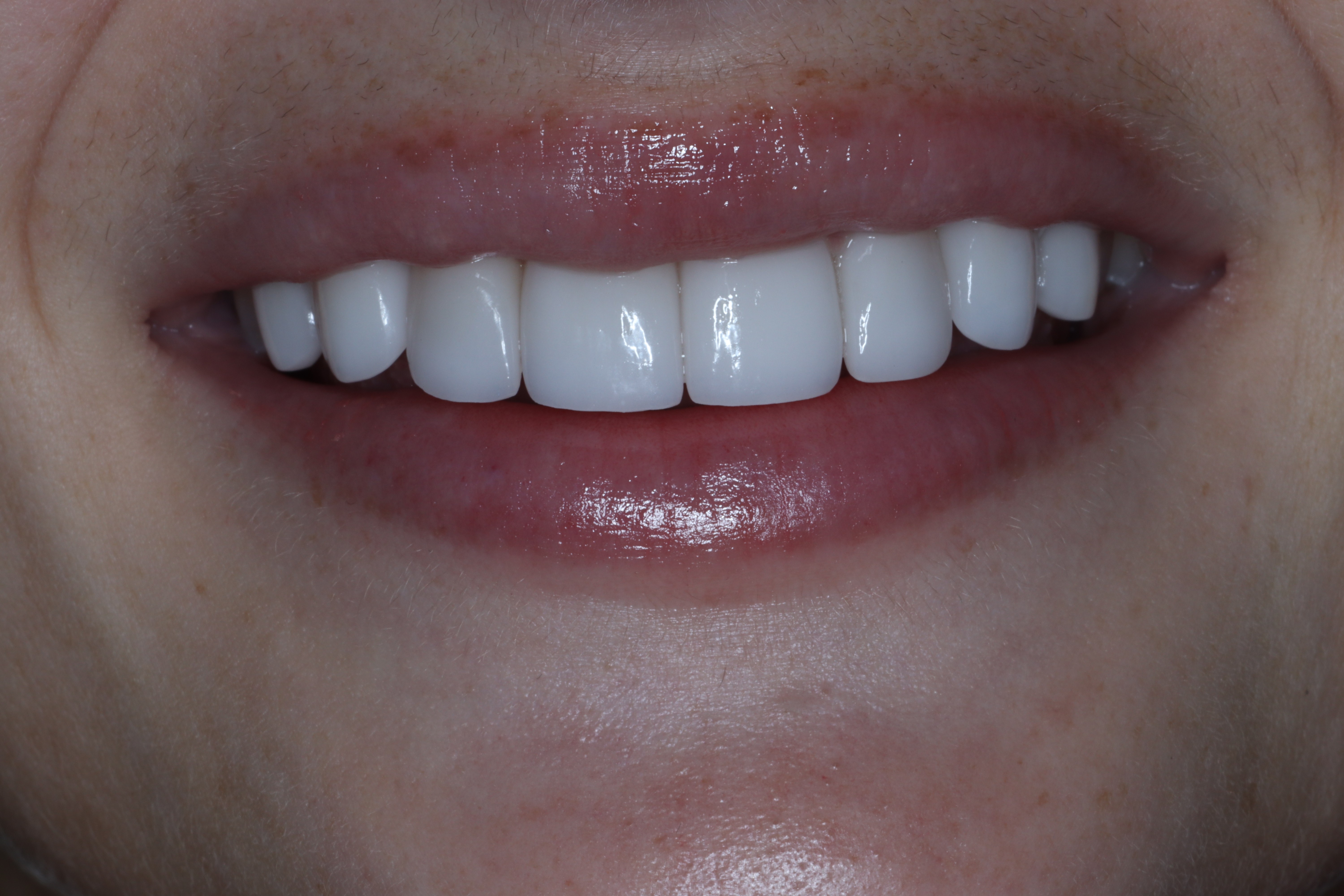 After Image