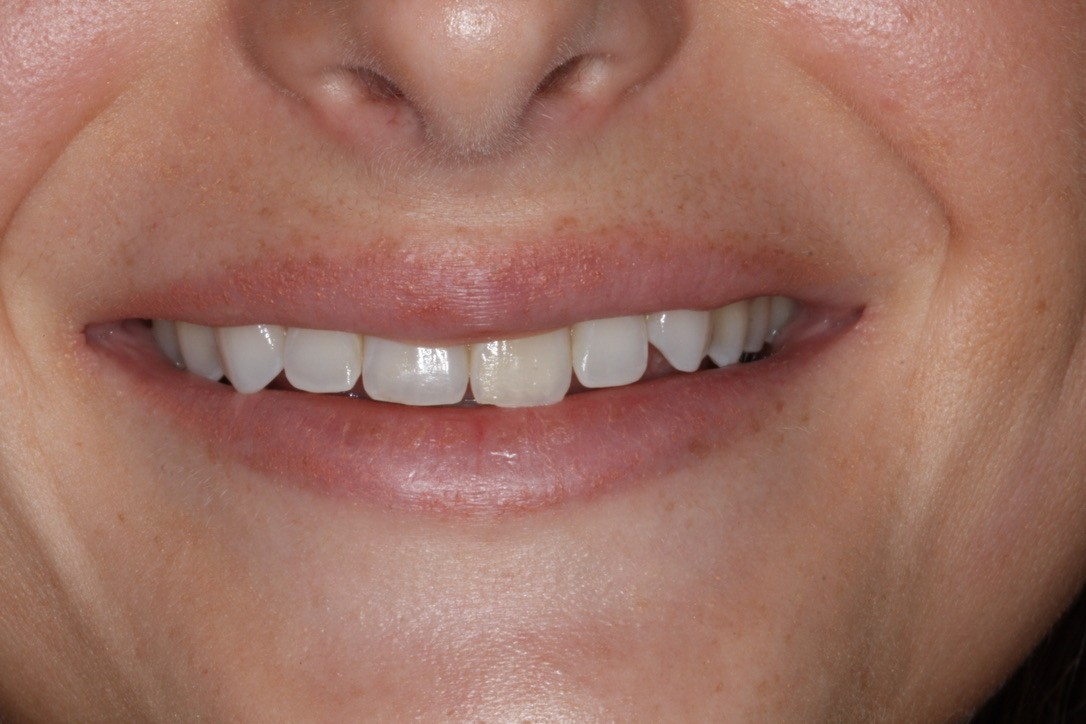 Before Image