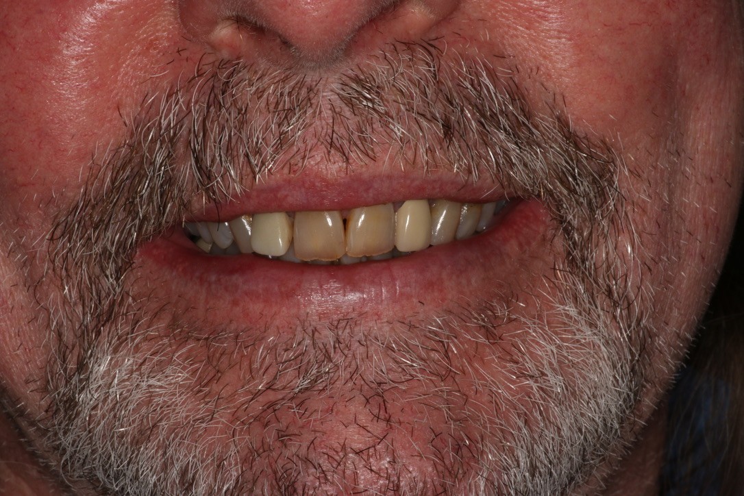 Before Image