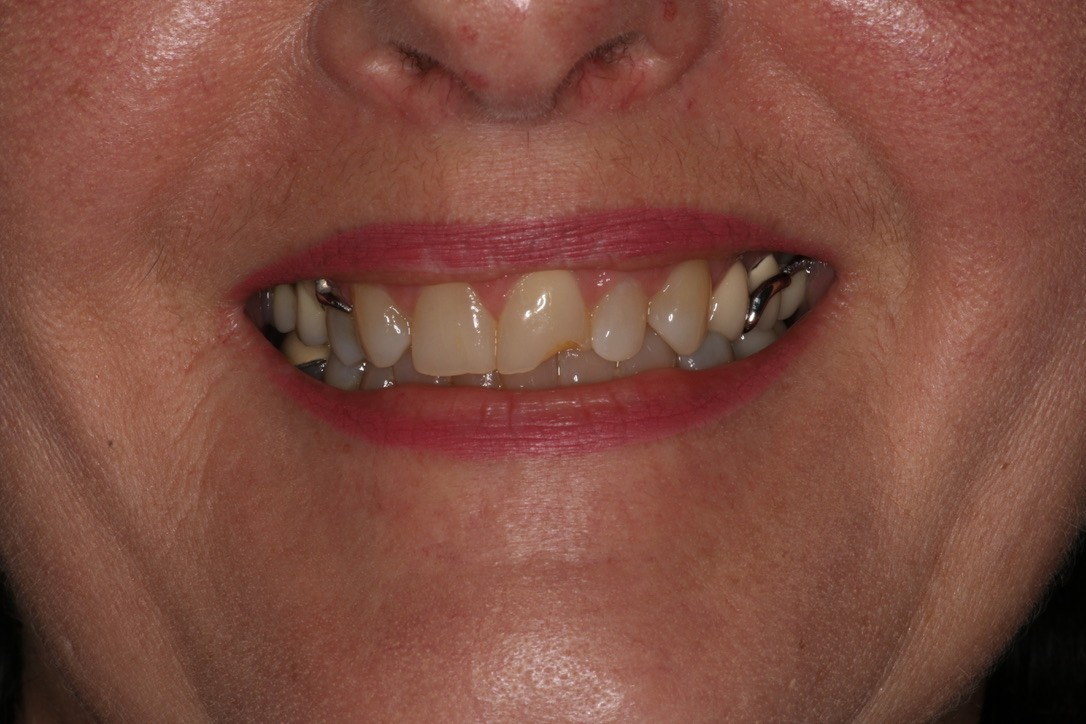 Before Image