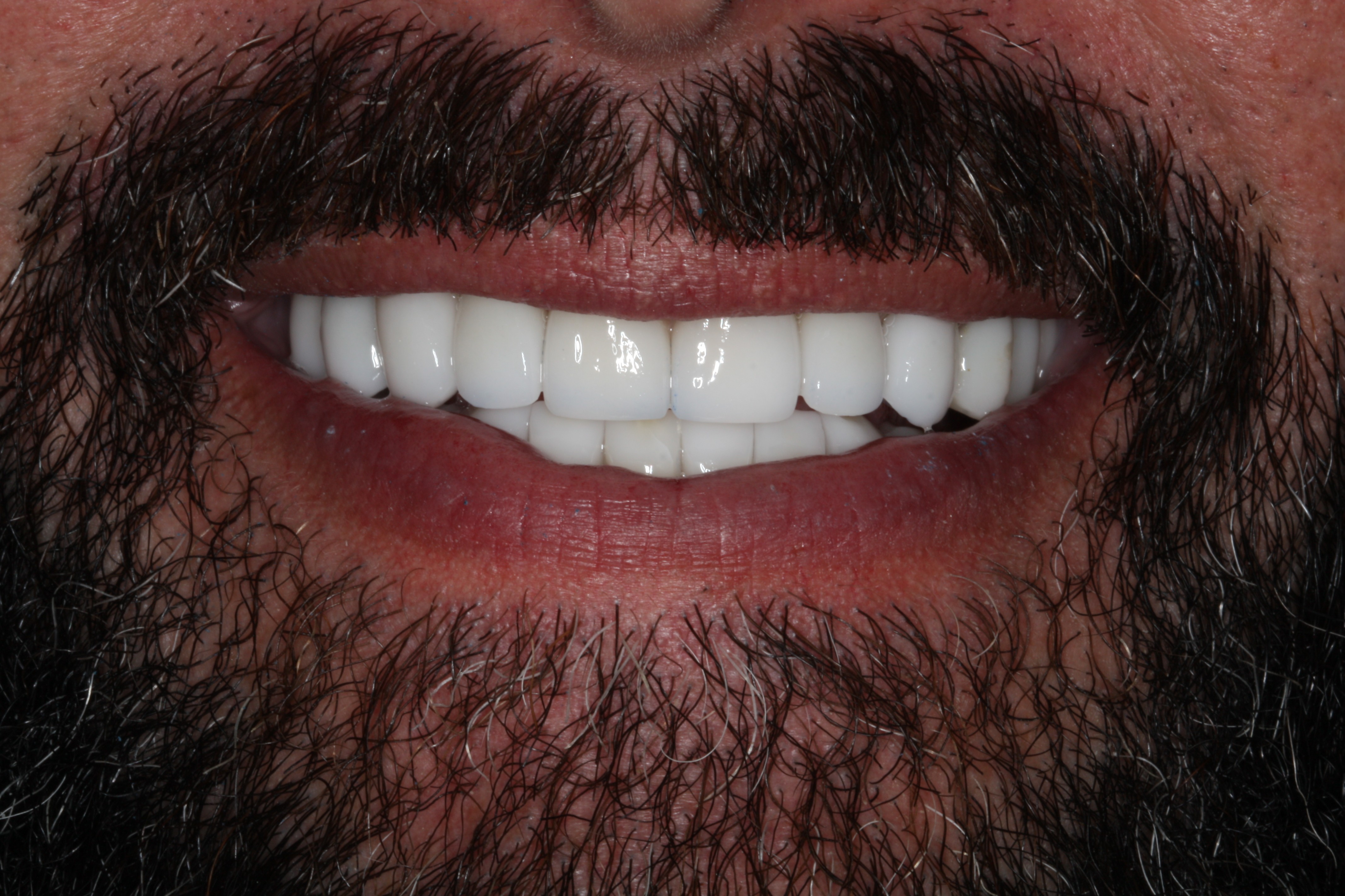 After Image