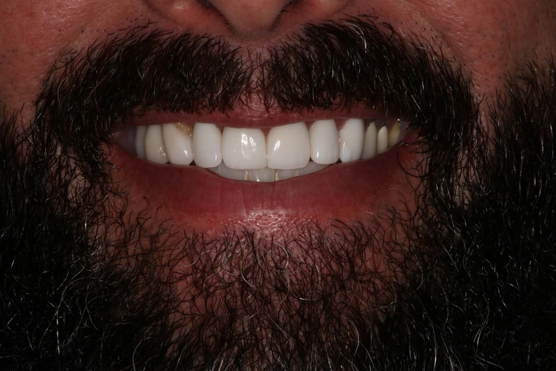 Before Image