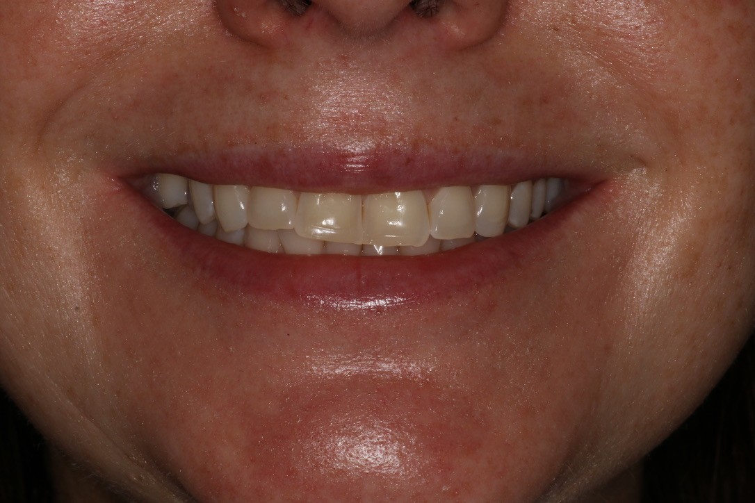 Before Image