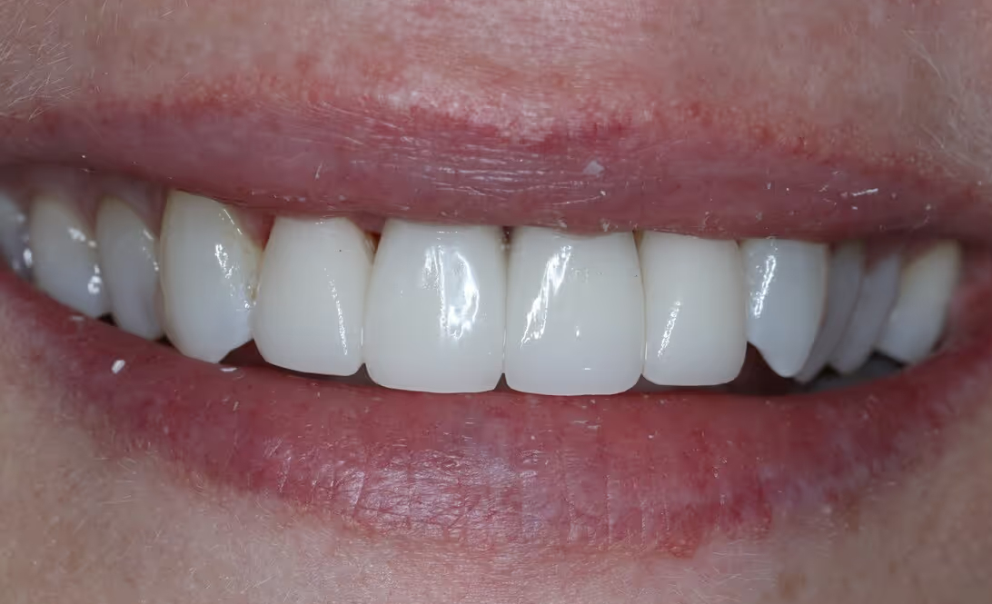 After Image