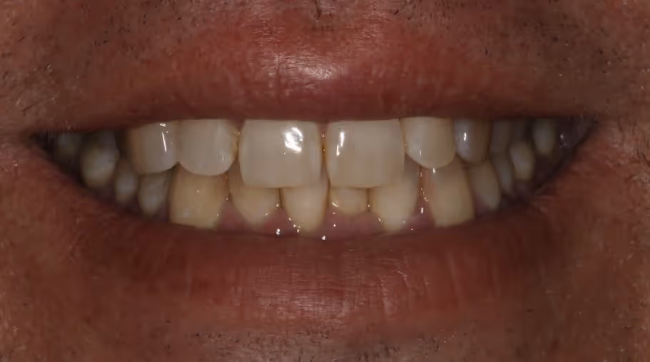 Before Image