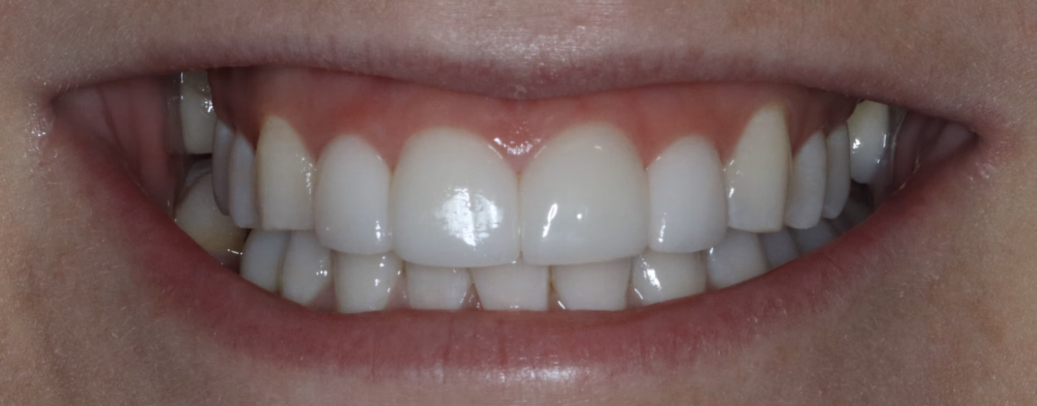 After Image