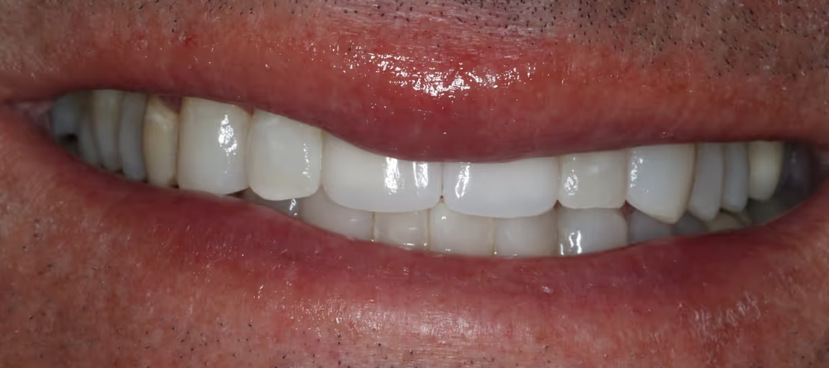 After Image