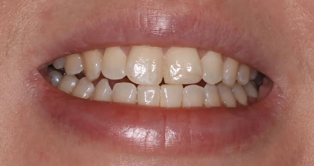 Before Image