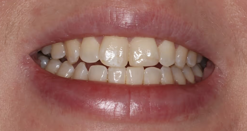 Before Image