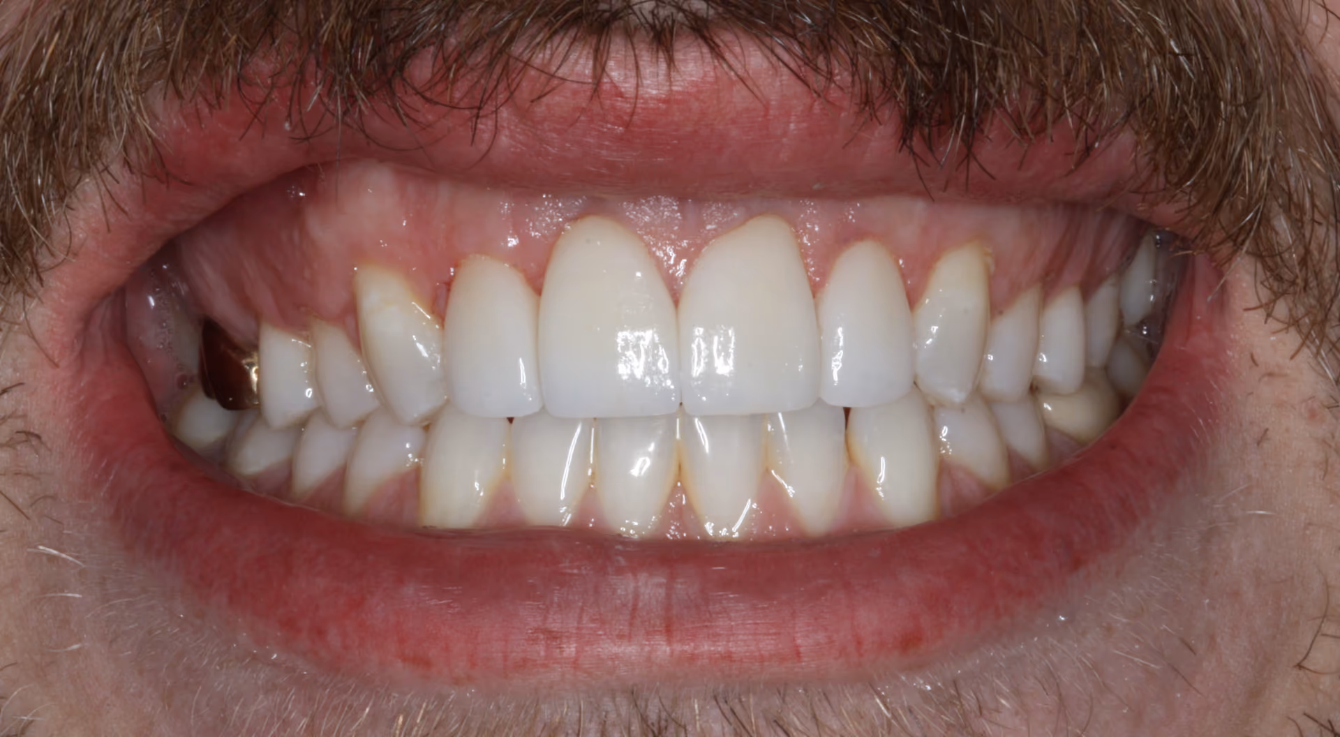 After Image