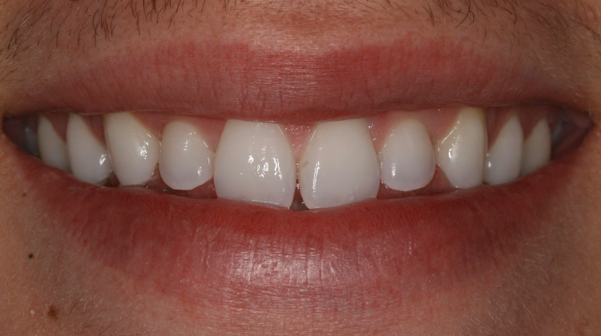 Before Image