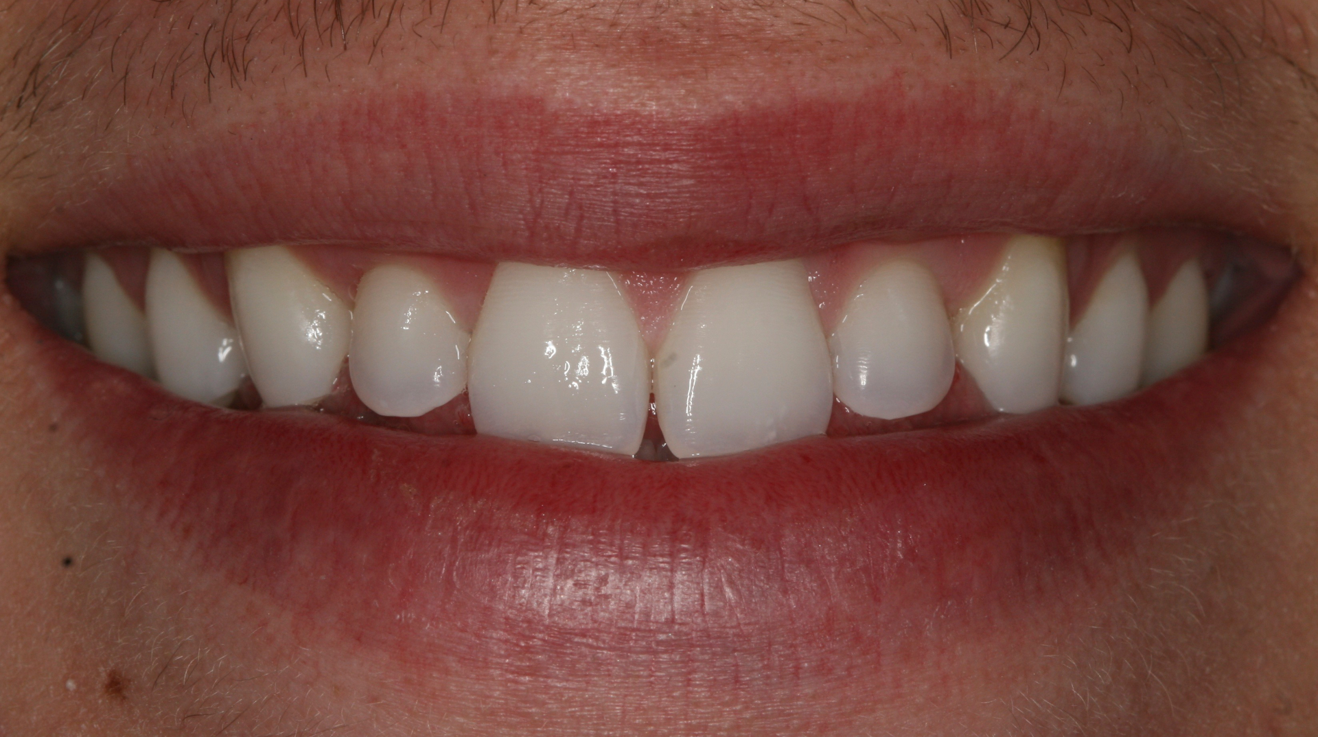 Before Image