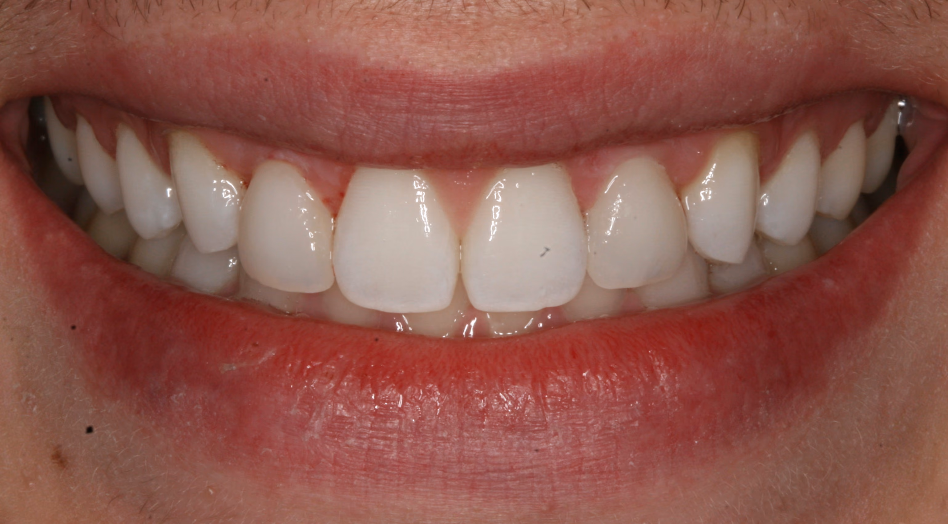 After Image