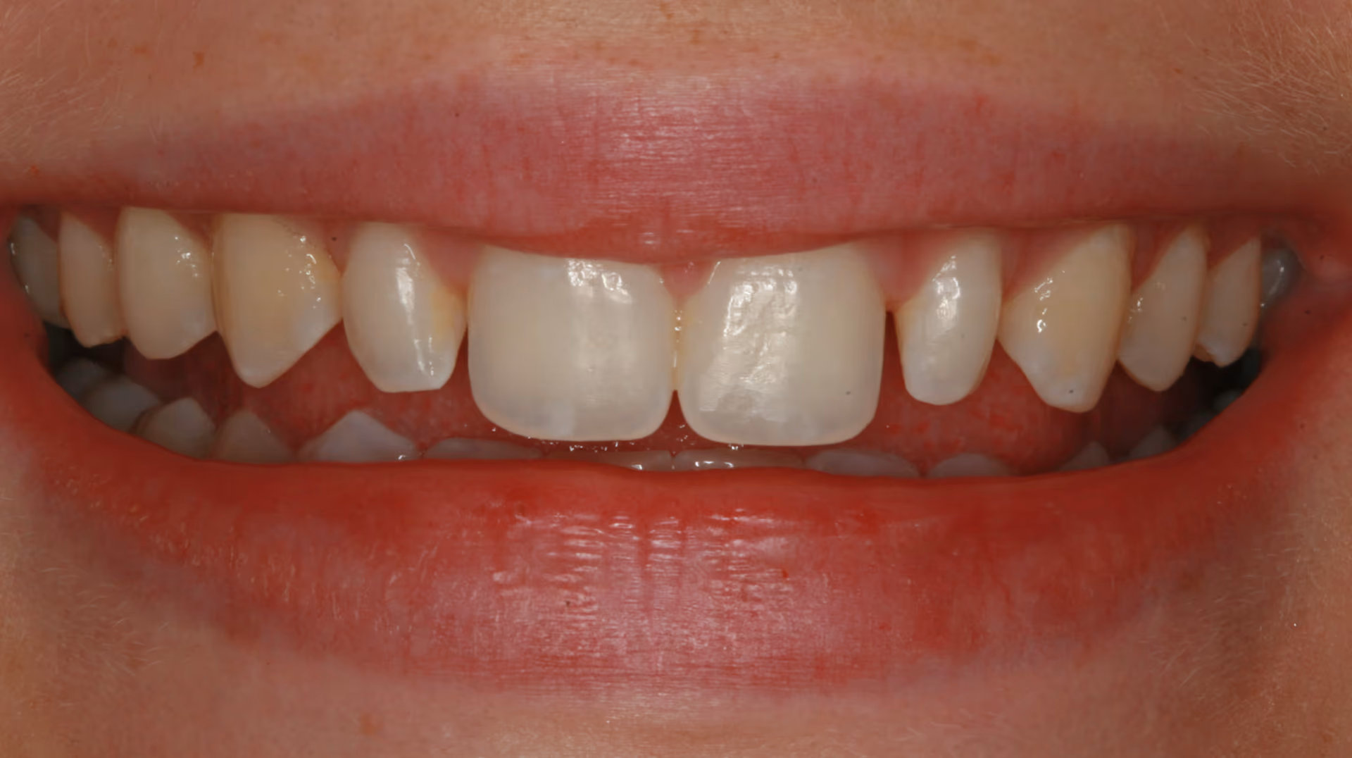 Before Image