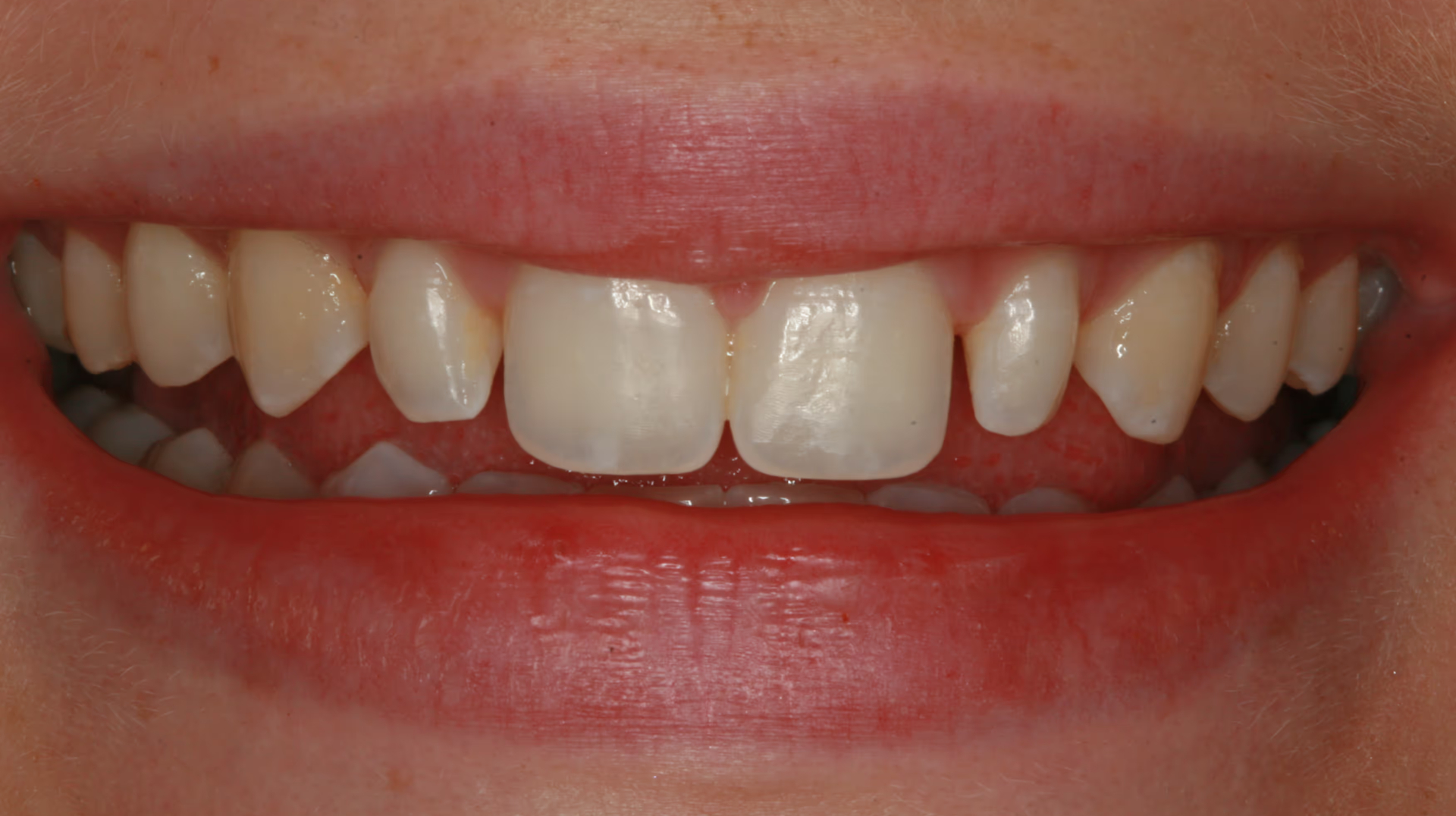 Before Image