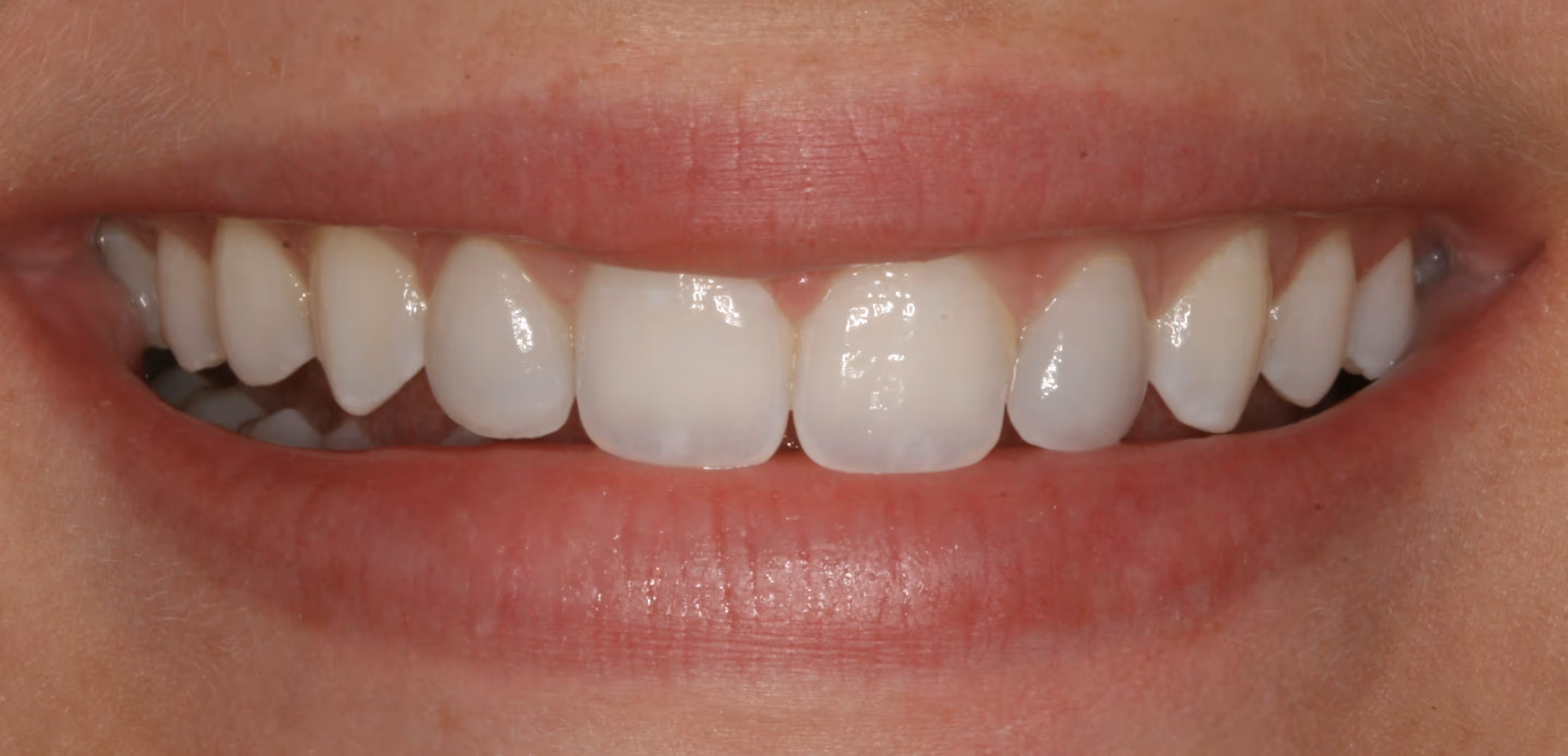 After Image