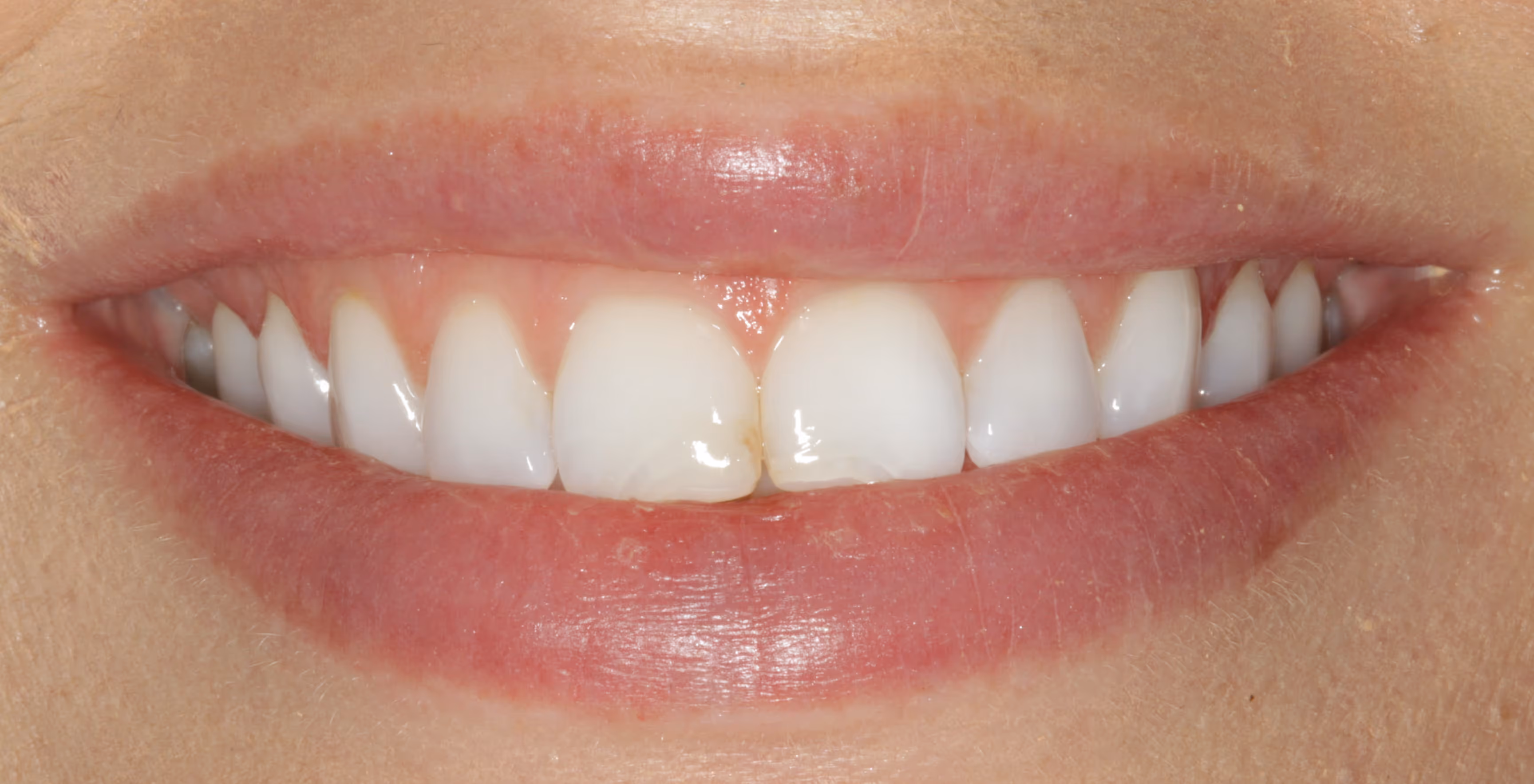 Before Image