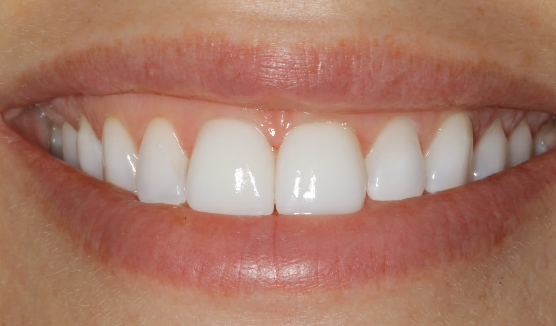 After Image