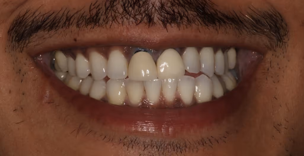 Before Image