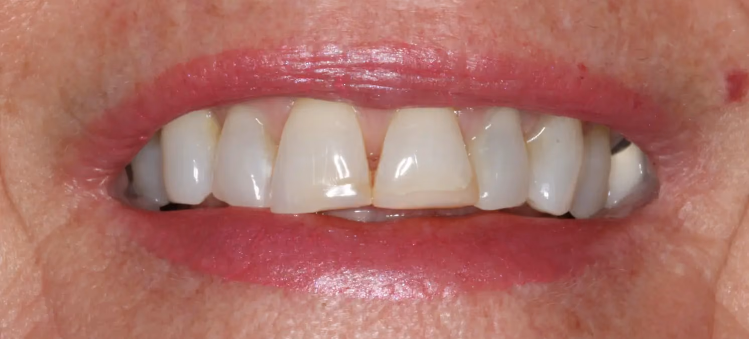 Before Image