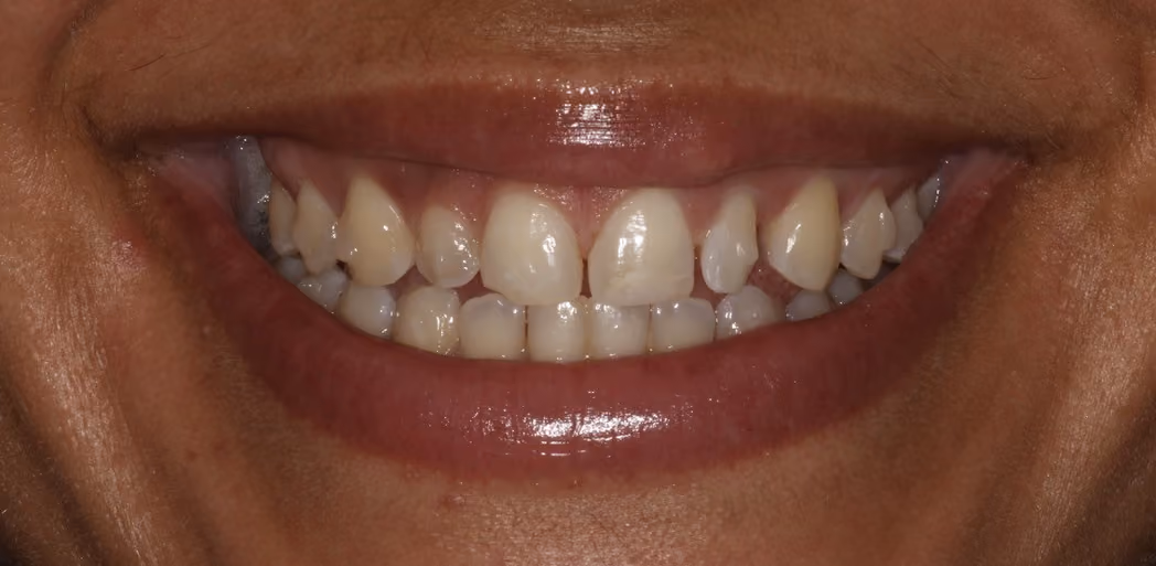 Before Image