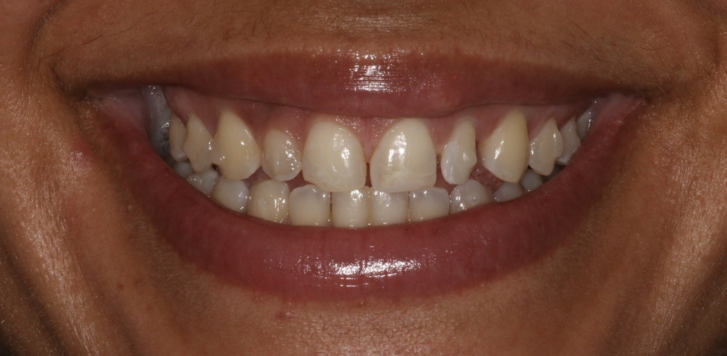 Before Image