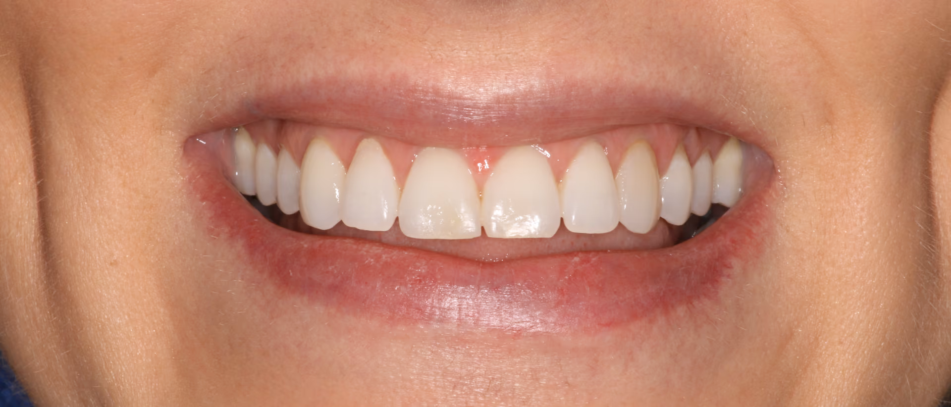 Before Image