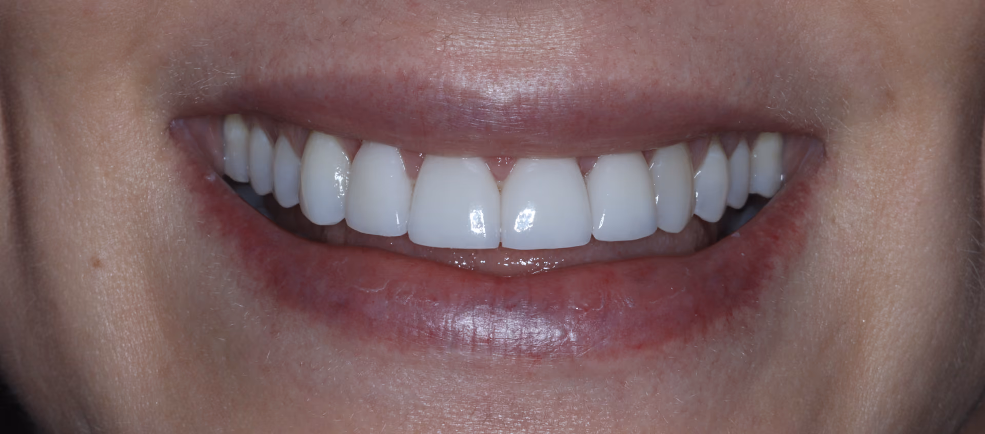 After Image