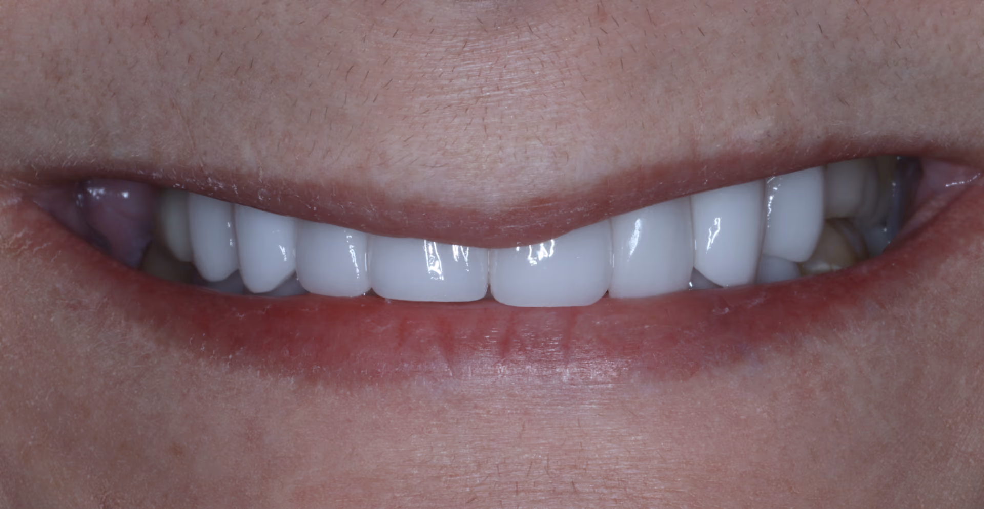 After Image