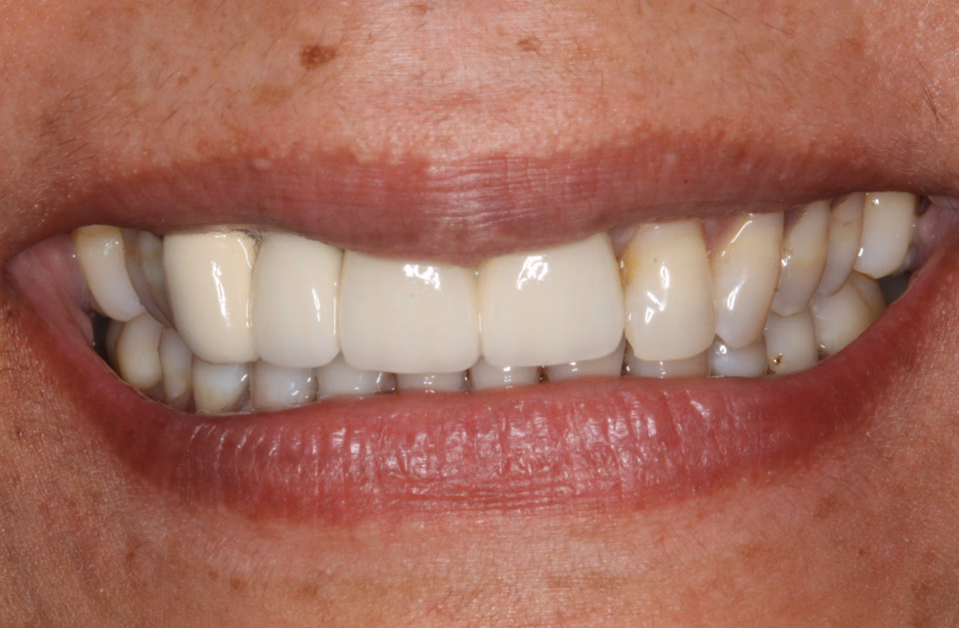 Before Image