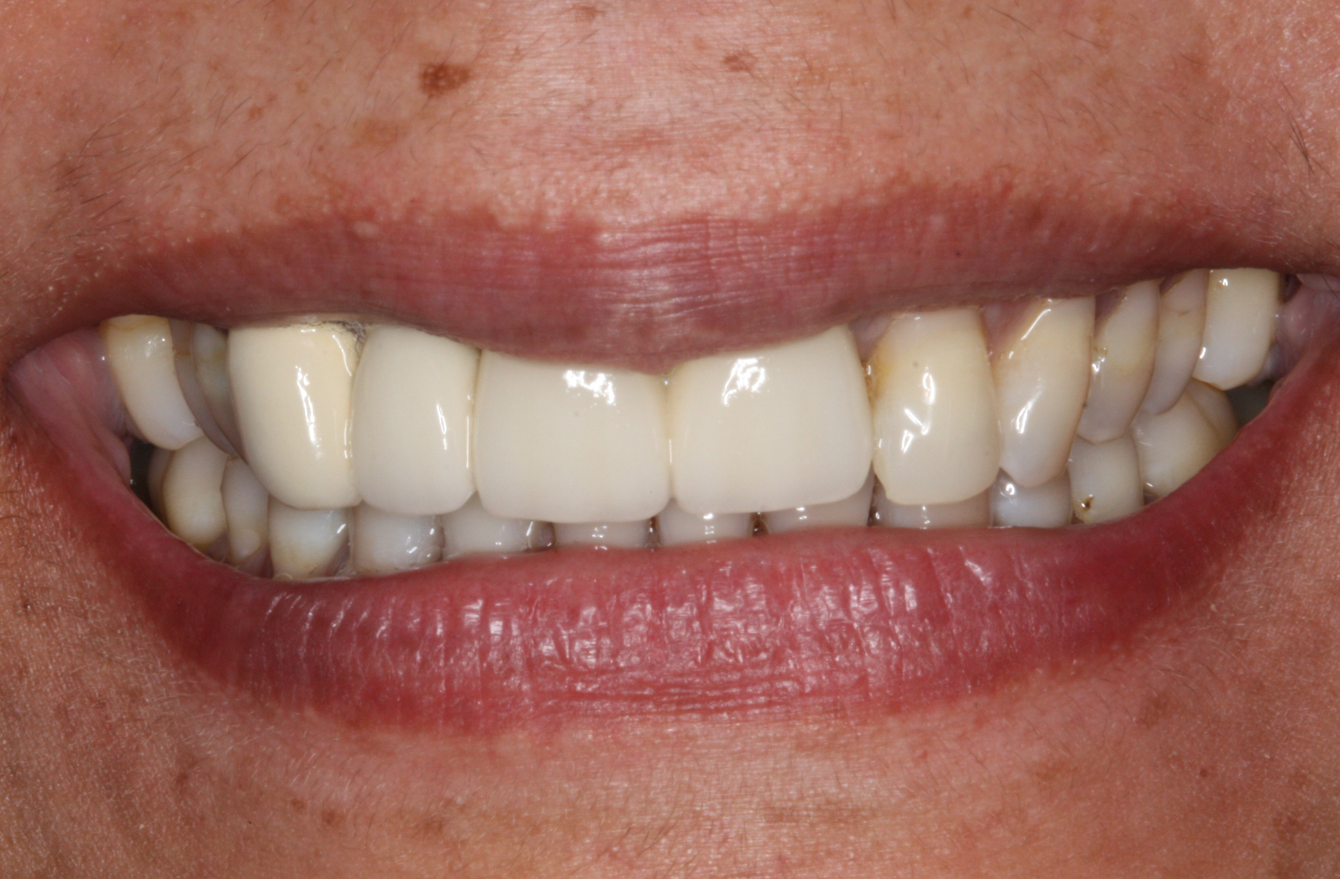 Before Image