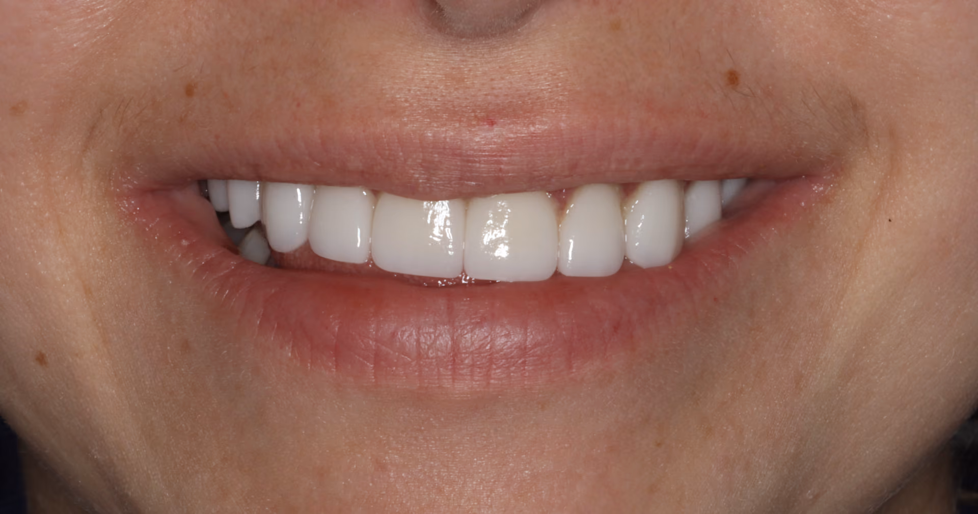 After Image