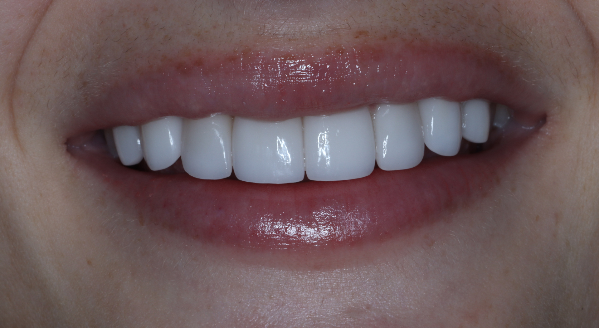 After Image