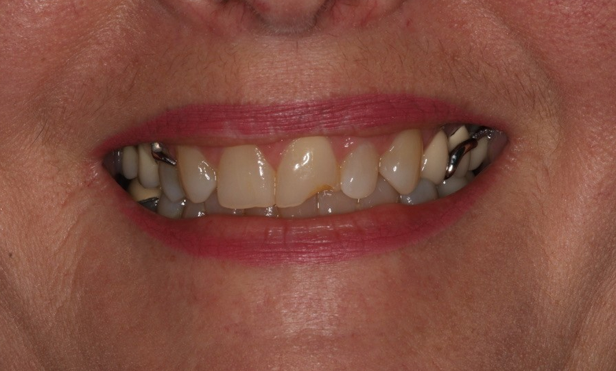 Before Image