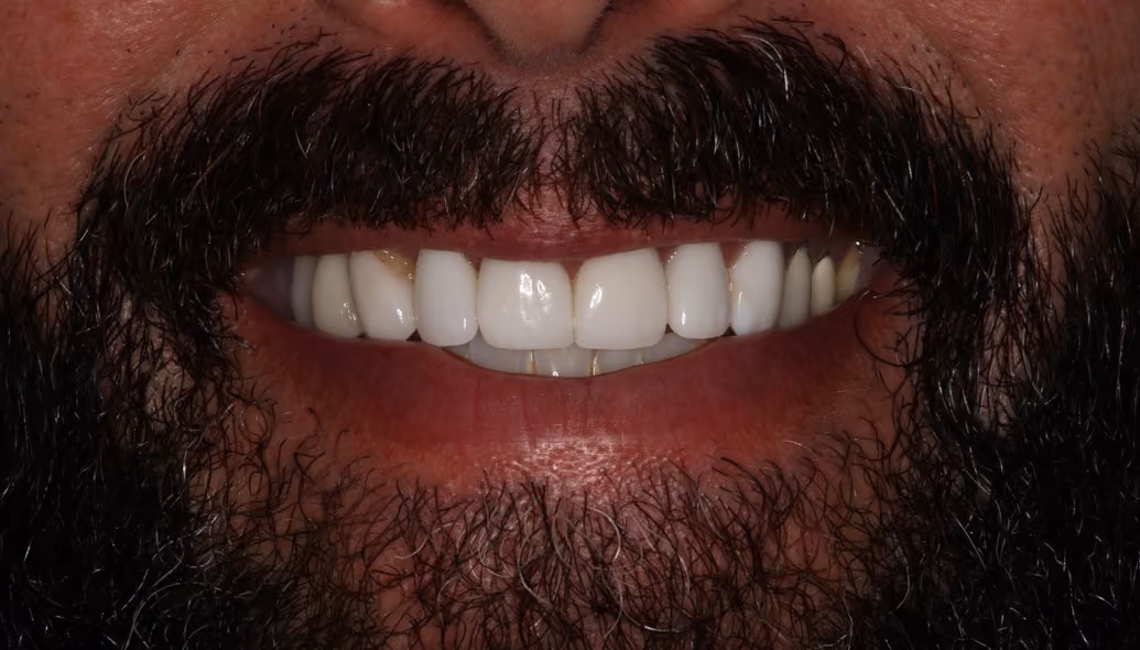 Before Image