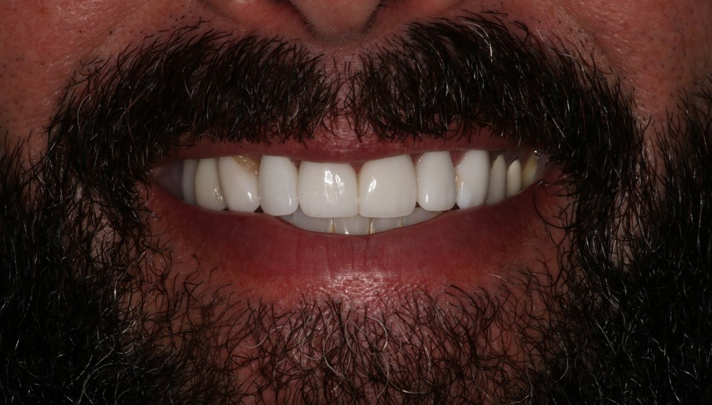 Before Image