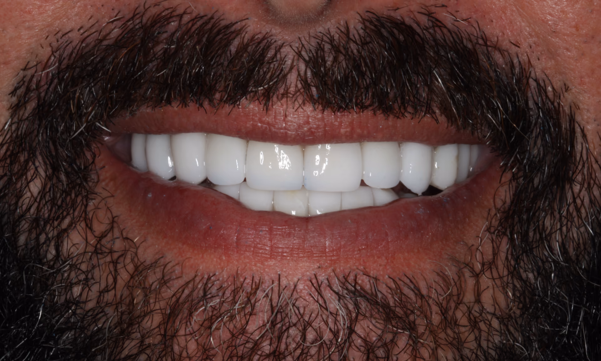 After Image
