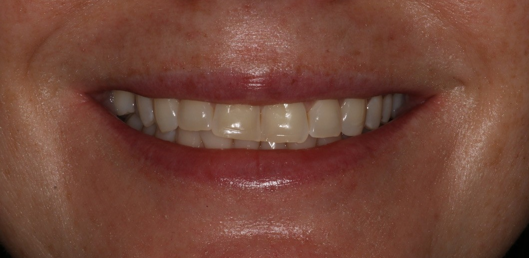 Before Image