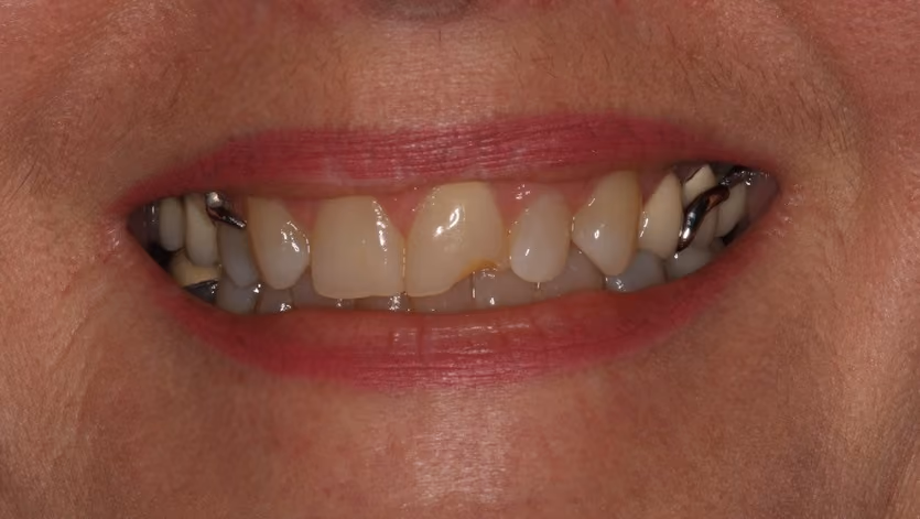 Before Image