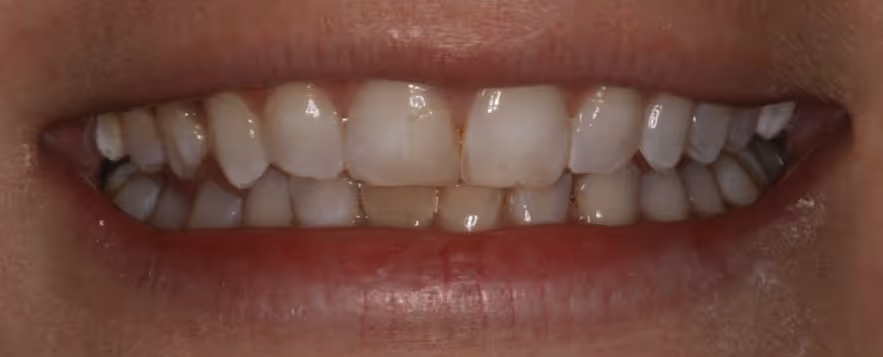 Before Image