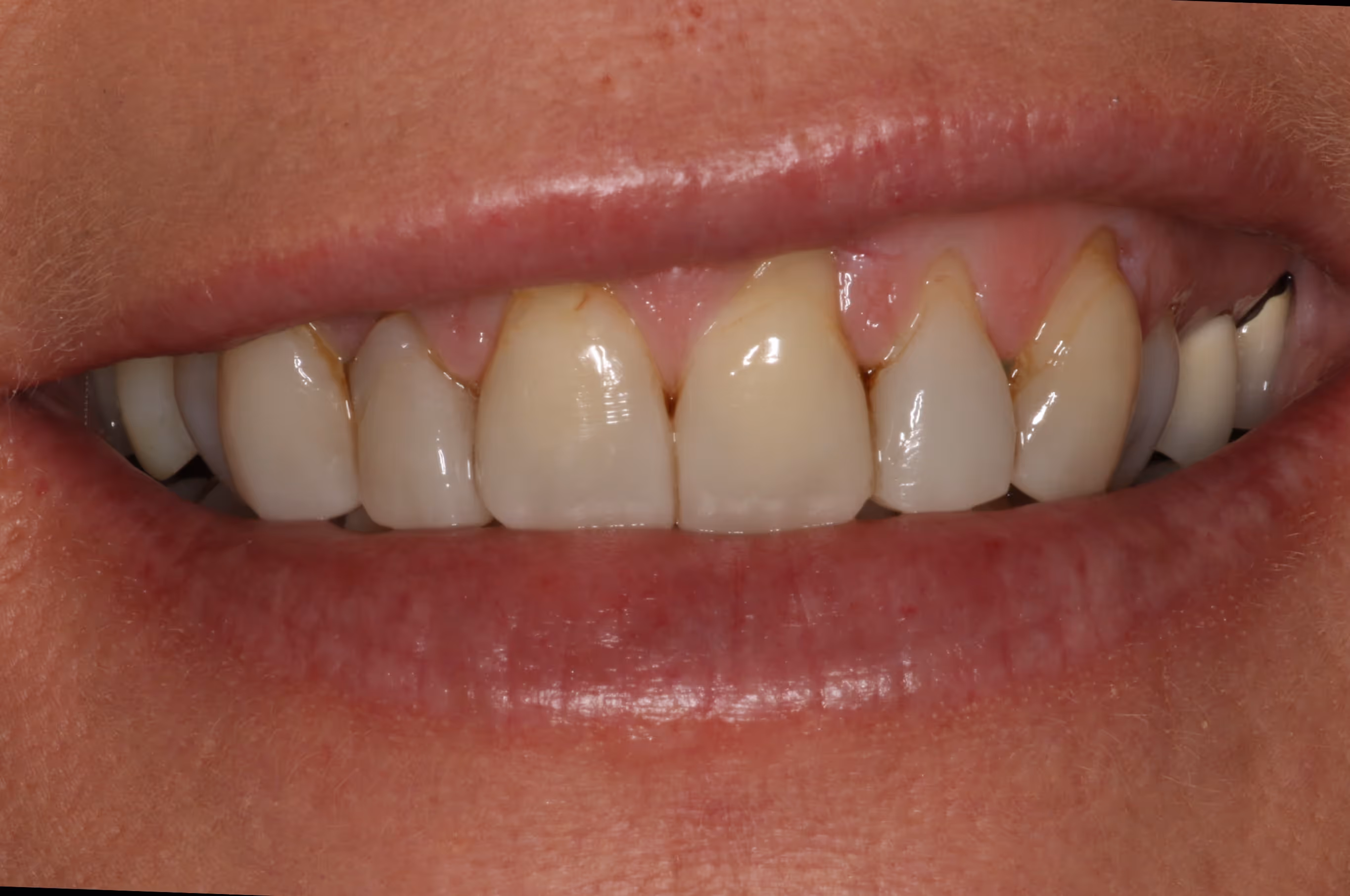 Before Image