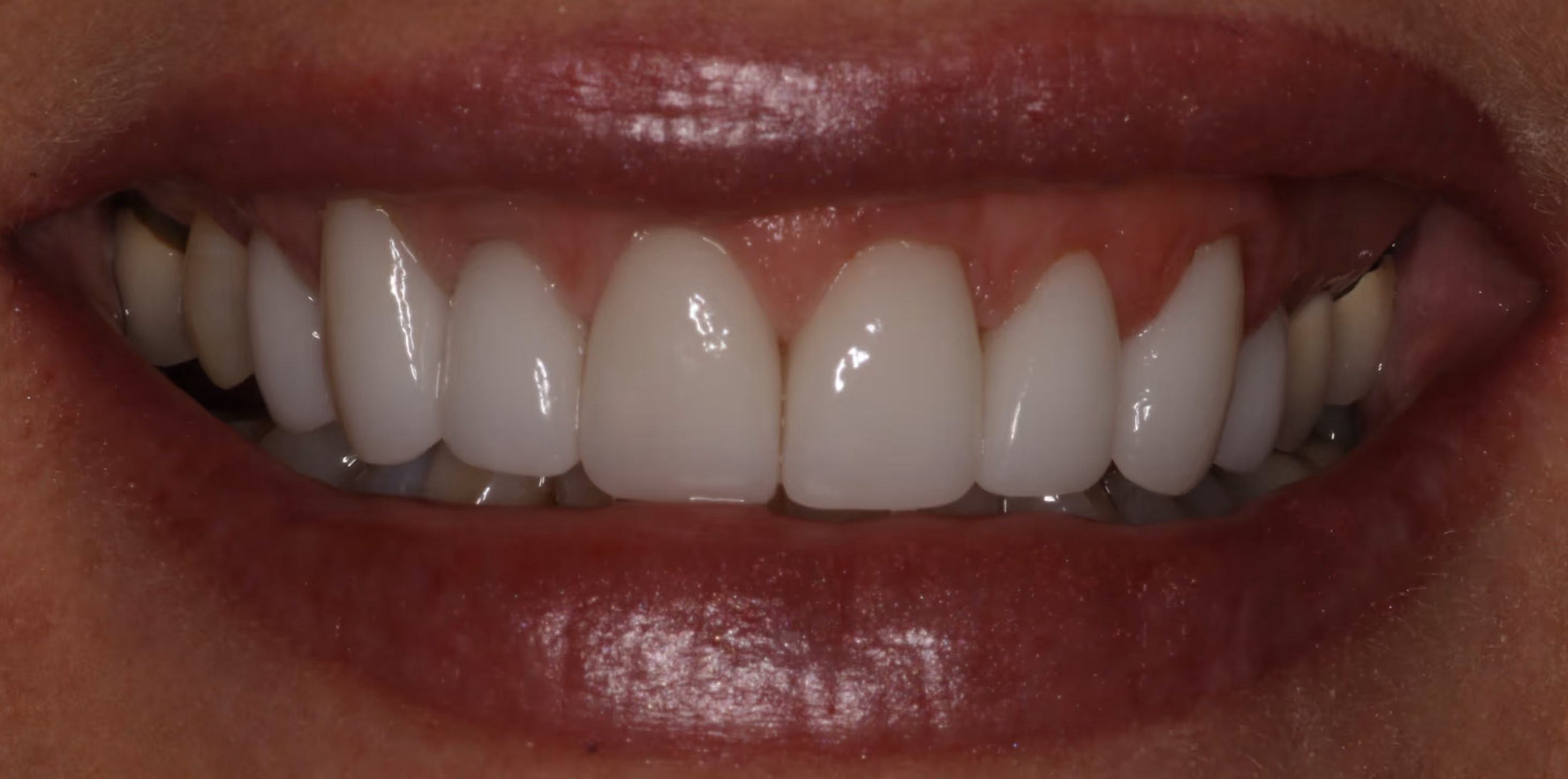 After Image