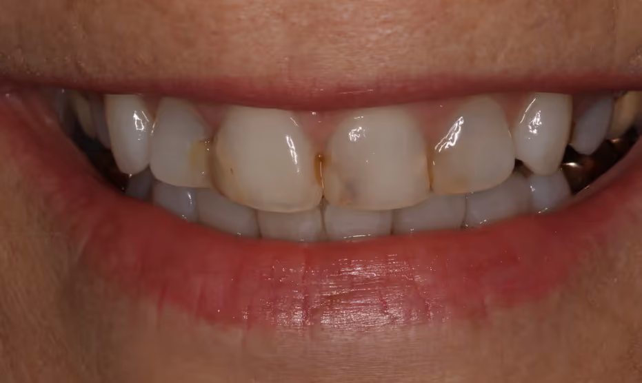 Before Image
