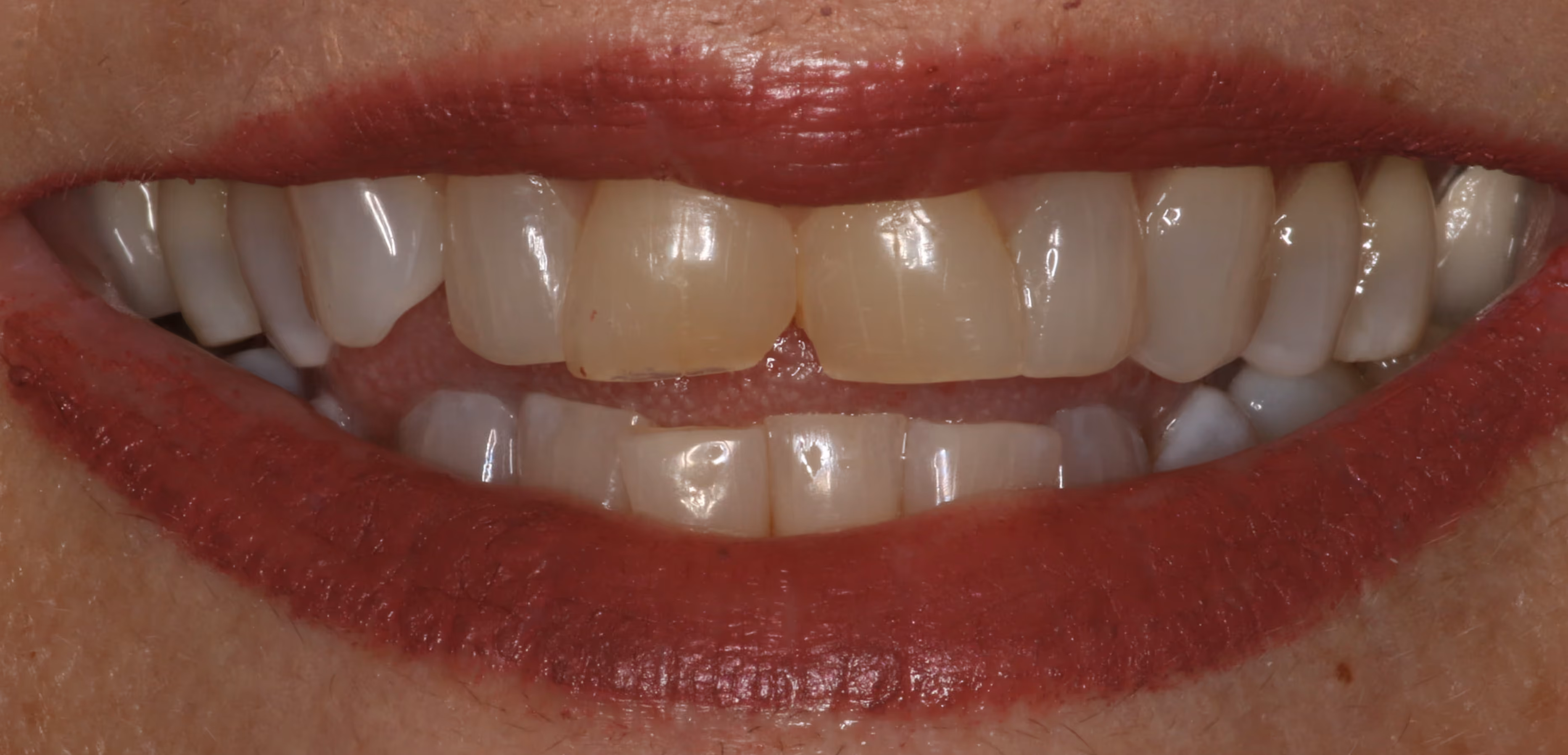 Before Image